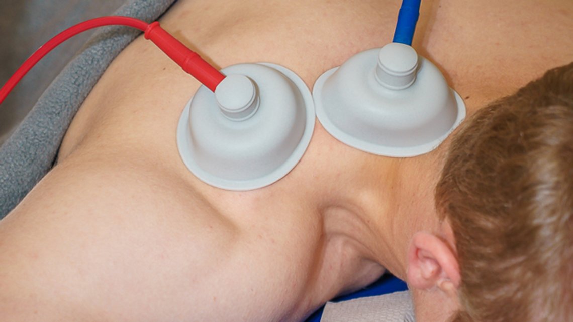 Schröpftherapie im Unterricht